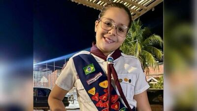 Imagem da notícia Família pede oração por menina de 10 anos que sofreu queimaduras com chapão em Coxim